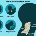 neck pain