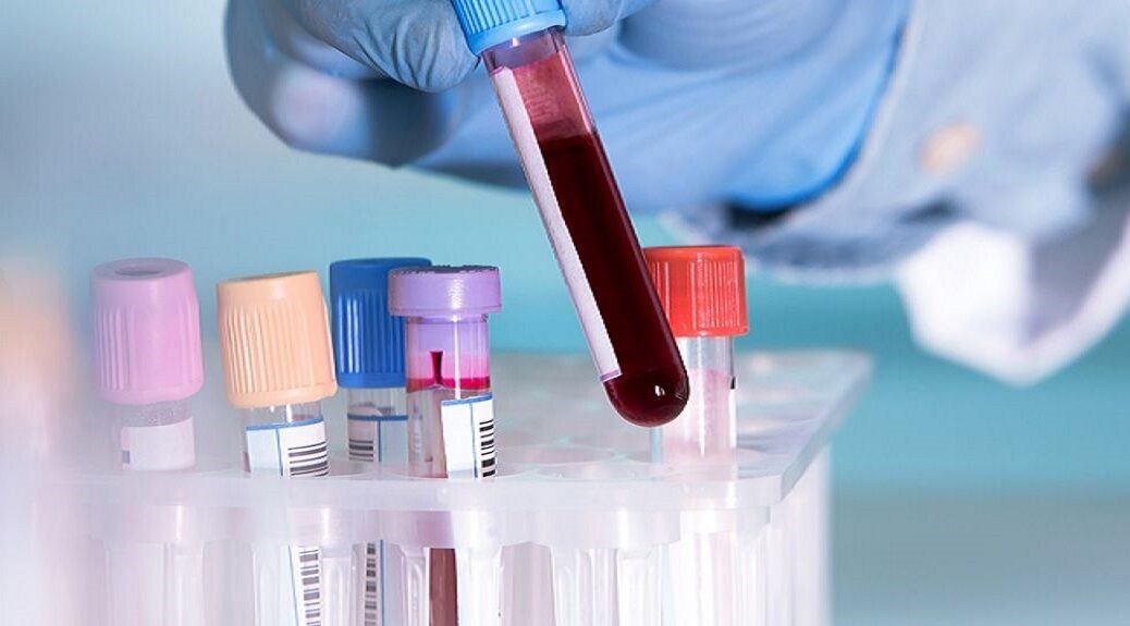 Home Blood Tests No More Doctor's Visits?